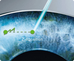 Latency-Free Tracking: Blickverfassung in der 7. Dimension